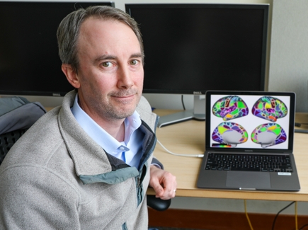 Equipo de investigacion de OHSU efectos generalizados y acumulativos del TDAH en el cerebro 1