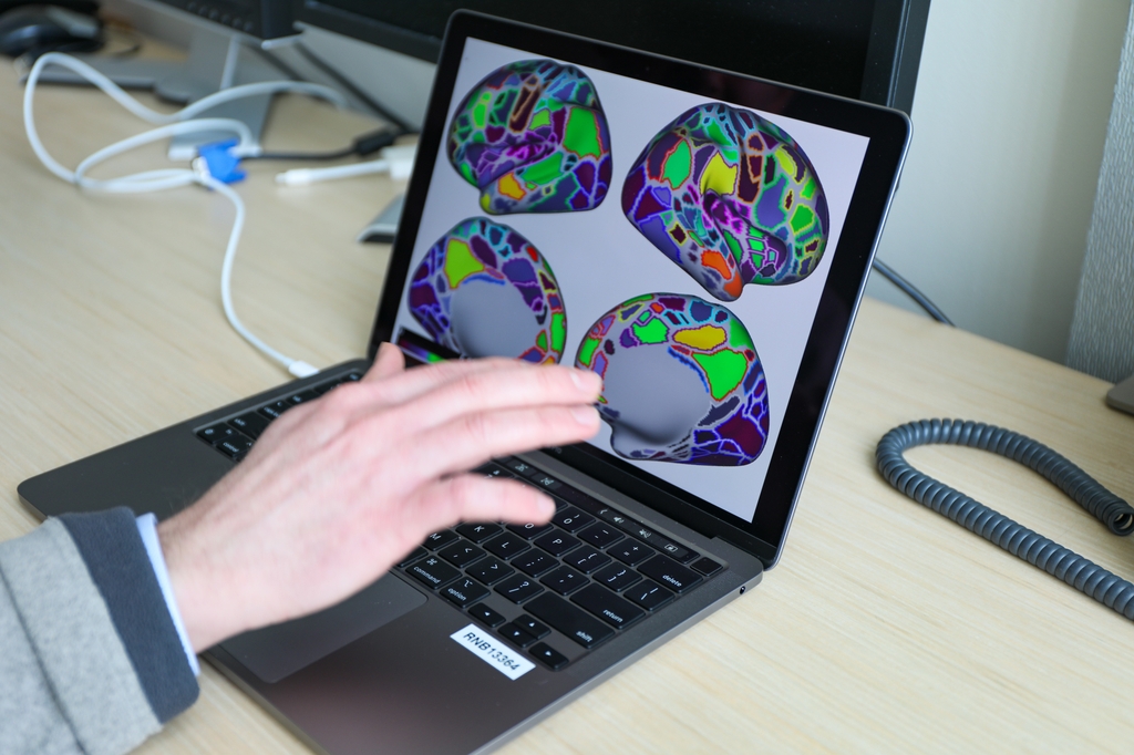 En un estudio dirigido por OHSU utilizaron neuroimágenes para confirmar los efectos generalizados del TDAH en el cerebro. (OHSU/Christine Torres Hicks)