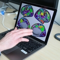 Equipo de investigación de OHSU efectos generalizados y acumulativos del TDAH en el cerebro