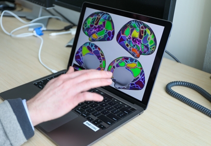 Equipo de investigacion de OHSU efectos generalizados y acumulativos del TDAH en el cerebro 2