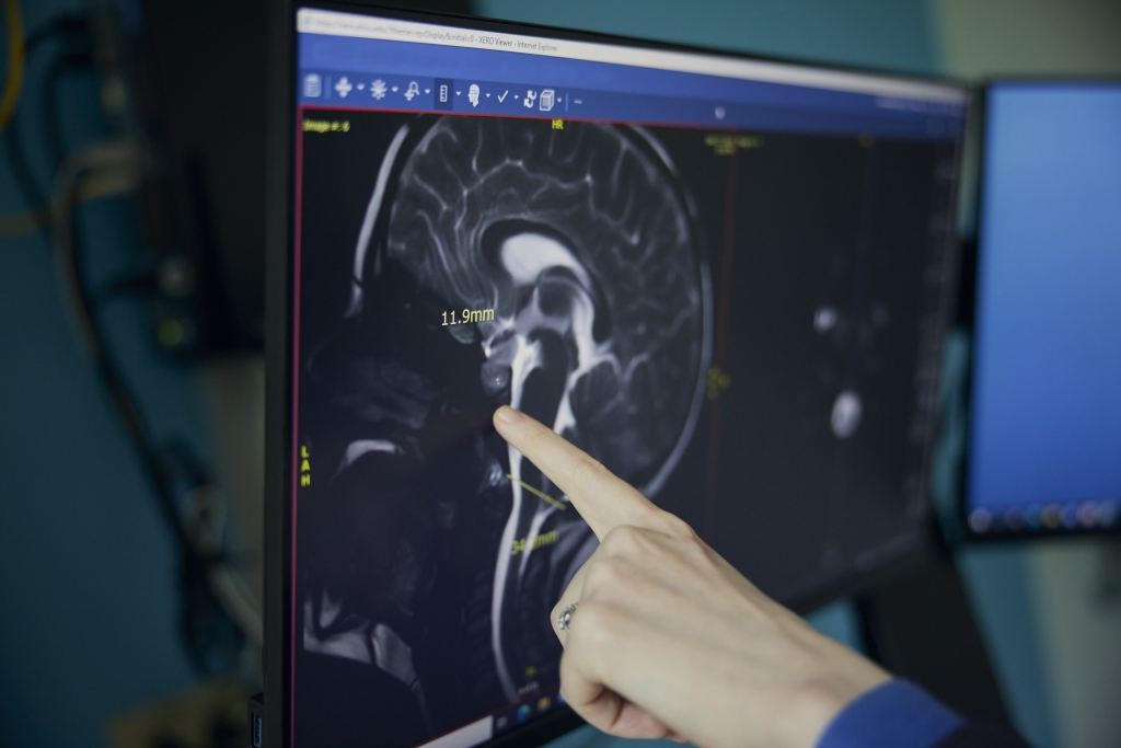 Doernbecher pediatrics - neurology