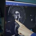 Doernbecher pediatrics - neurology