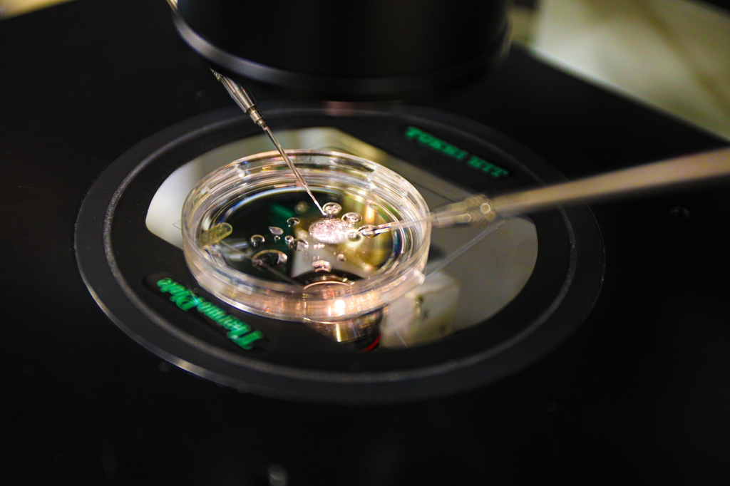 Los investigadores de OHSU están logrando avances en una estrategia basada en la transferencia nuclear de células somáticas para tratar la infertilidad a través de la gametogénesis in vitro o IVG. Un estudio publicado hoy describe la ciencia detrás de la técnica demostrada en una prueba con ratones. (OHSU/Christine Torres Hicks)