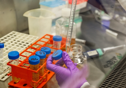 New drug combinations could improve therapies for breast cancer, other aggressive cancers