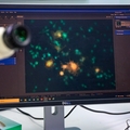 Compuesto natural que se encuentra en flores detiene el avance de la esclerosis múltiple, algunos cánceres