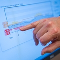 Semaglutide and Type 1 diabetes