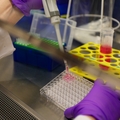 Científicos de OHSU desarrollan el primer modelo transgénico para la investigacion de la hepatitis B