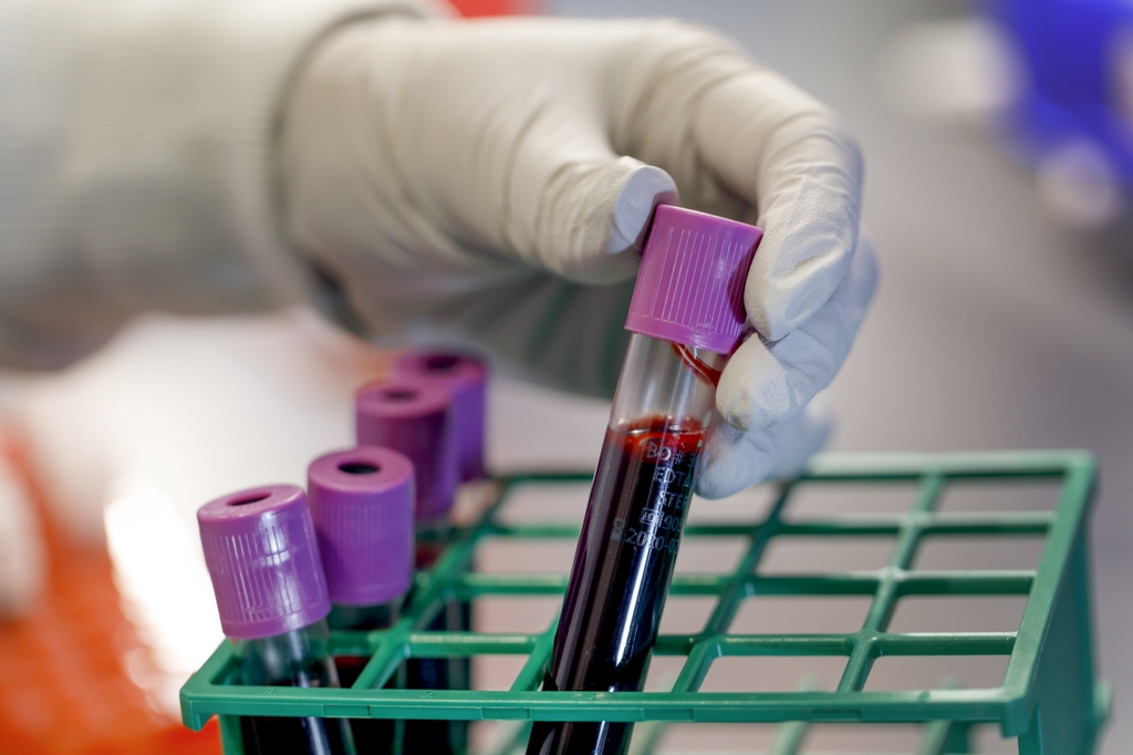 En nueva investigación se revela que un fármaco desarrollado por científicos/as en Oregon Health & Science University puede convertirse en un nuevo tratamiento para formas particularmente agresivas de cáncer de mama. (OHSU)