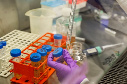 New drug combinations could improve therapies for breast cancer other aggressive cancers