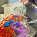 New drug combinations could improve therapies for breast cancer other aggressive cancers