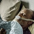 Untreated sleep apnea raises risk of Parkinsons study finds
