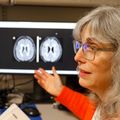 Mixed results in using lipoic acid to treat progressive multiple sclerosis