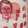 OHSU earns $7 million to study treatments for inflammatory sinus disease 