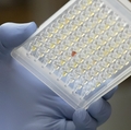 Study suggests long COVID is more prevalent than previously thought
