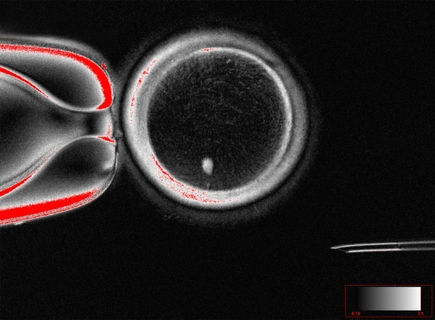 Investigadores de OHSU desarrollan óvulos funcionales de células de piel humana