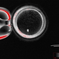 OHSU researchers develop functional eggs from human skin cells