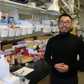 Un proyecto busca desarrollar un método de detección de Alzheimer mediante prueba de la retina.