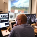 Incisionless brain surgery