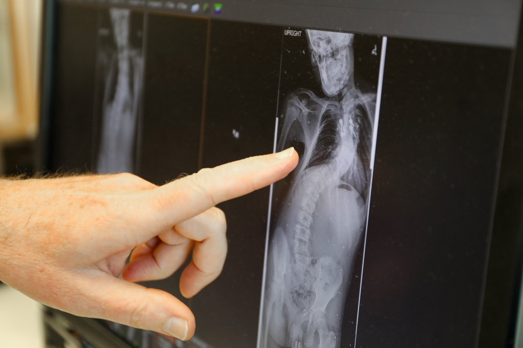 Spine conditions and complex care 