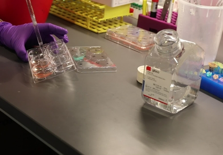 B-roll: Pipettes and liquid