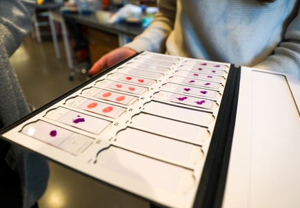 Breakthroughs in cancer research