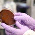 Oral bacteria culture grown in OHSU research laboratory