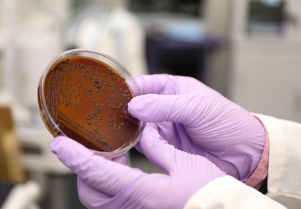 Oral bacteria culture grown in OHSU research laboratory