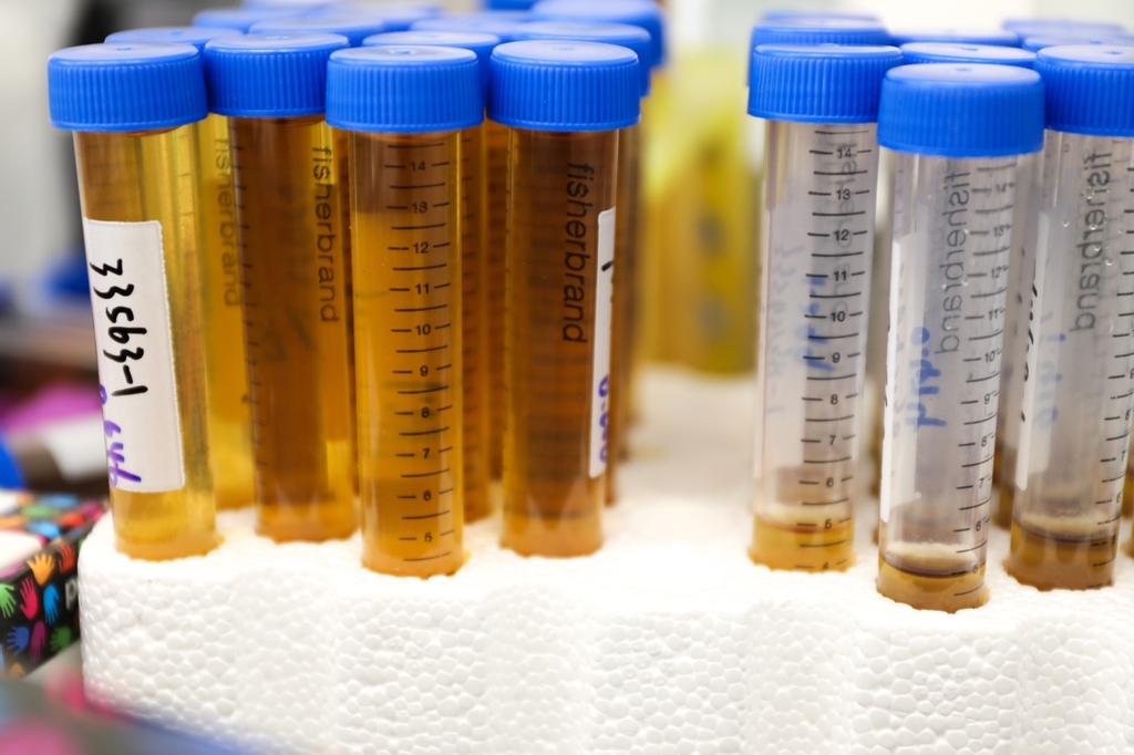 Bacterial samples prepared for oral microbiome research at OHSU