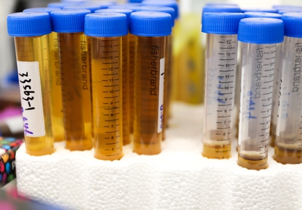 Bacterial samples prepared for oral microbiome research at OHSU