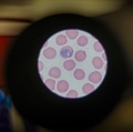 Estudio revela vías para una vacuna universal contra la malaria