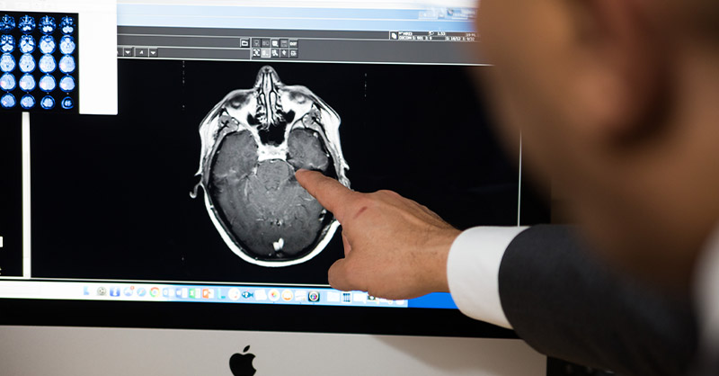 Photo: news.ohsu.edu Global Study Reveals Traumatic Brain Injury Causes and Outcomes Vary by Development Tier