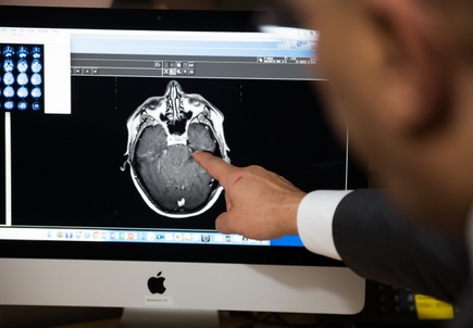 Causes of traumatic brain injury vary widely worldwide, study finds