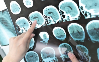 A501~brain scan_16x9