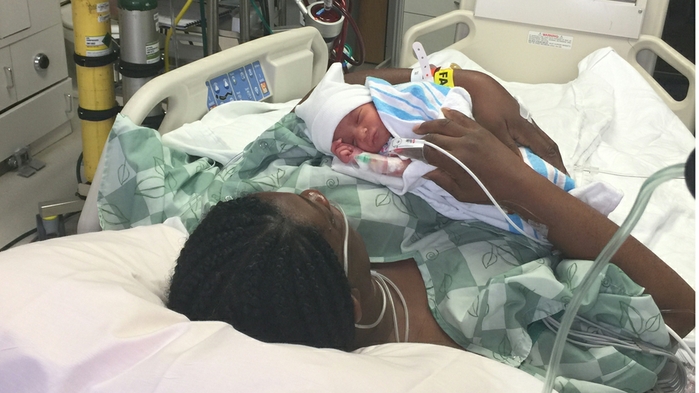 Pregnant woman and daughter saved by ECMO  technology