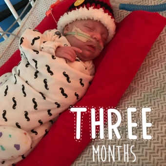 preemie Lincoln Allen