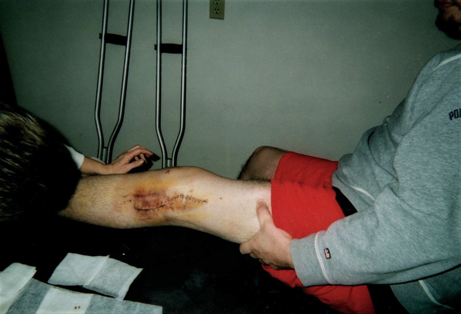 greg lester stitches