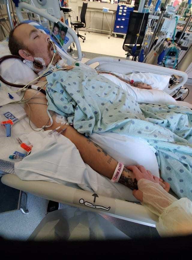 Jamie Calcasola, pictured at NHRMC while on an ECMO machine.