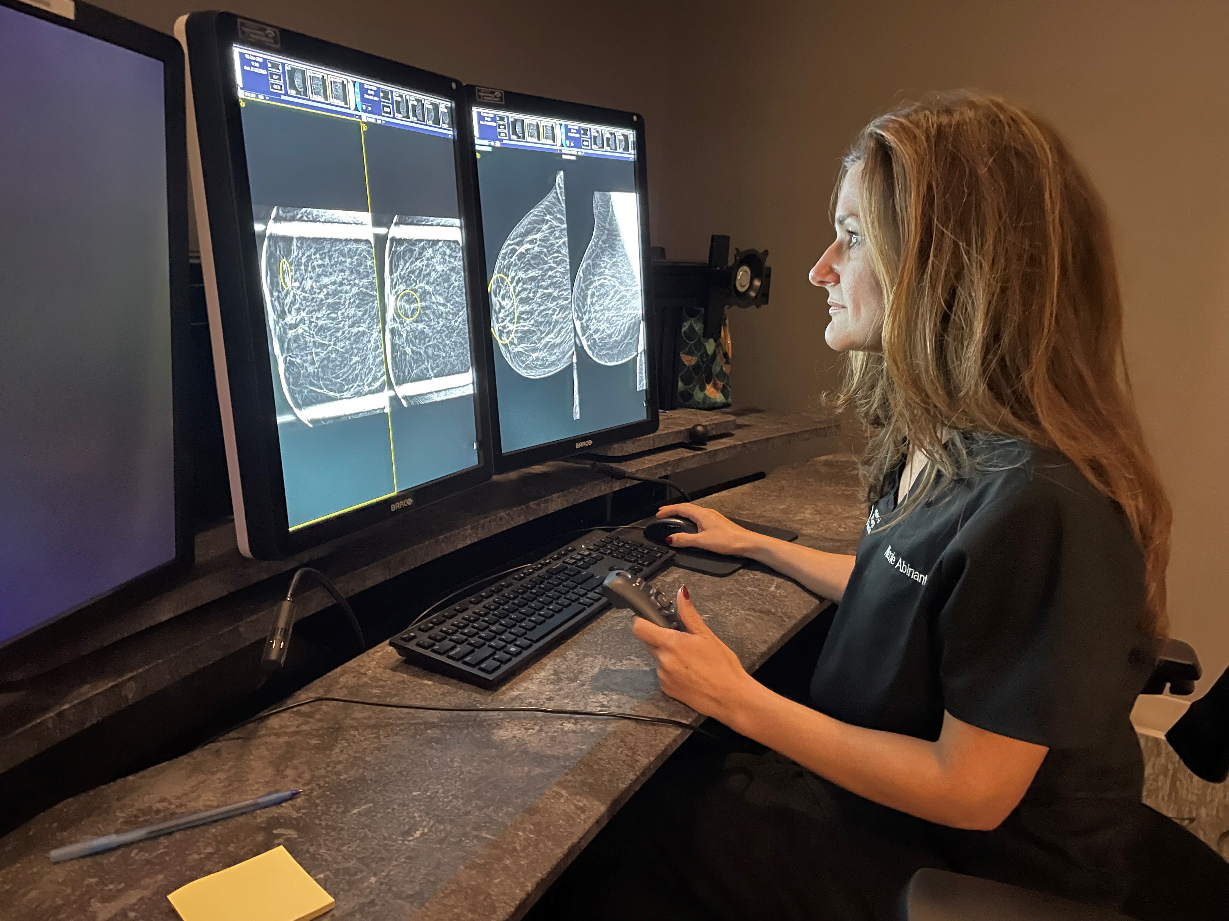 Mint Hill Cancer Abinanti