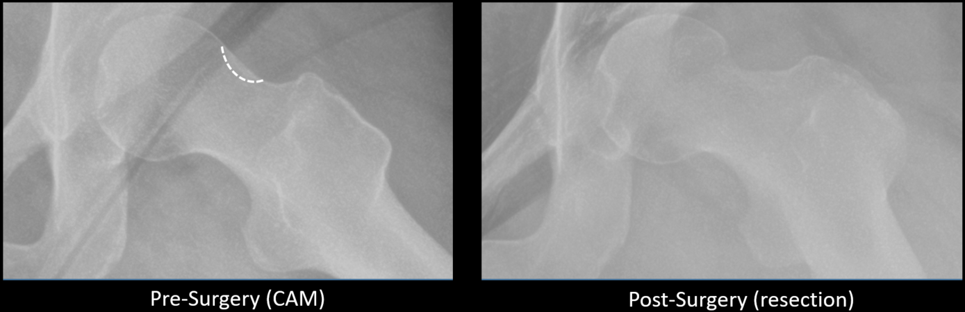 Lucas Johnson x-rays