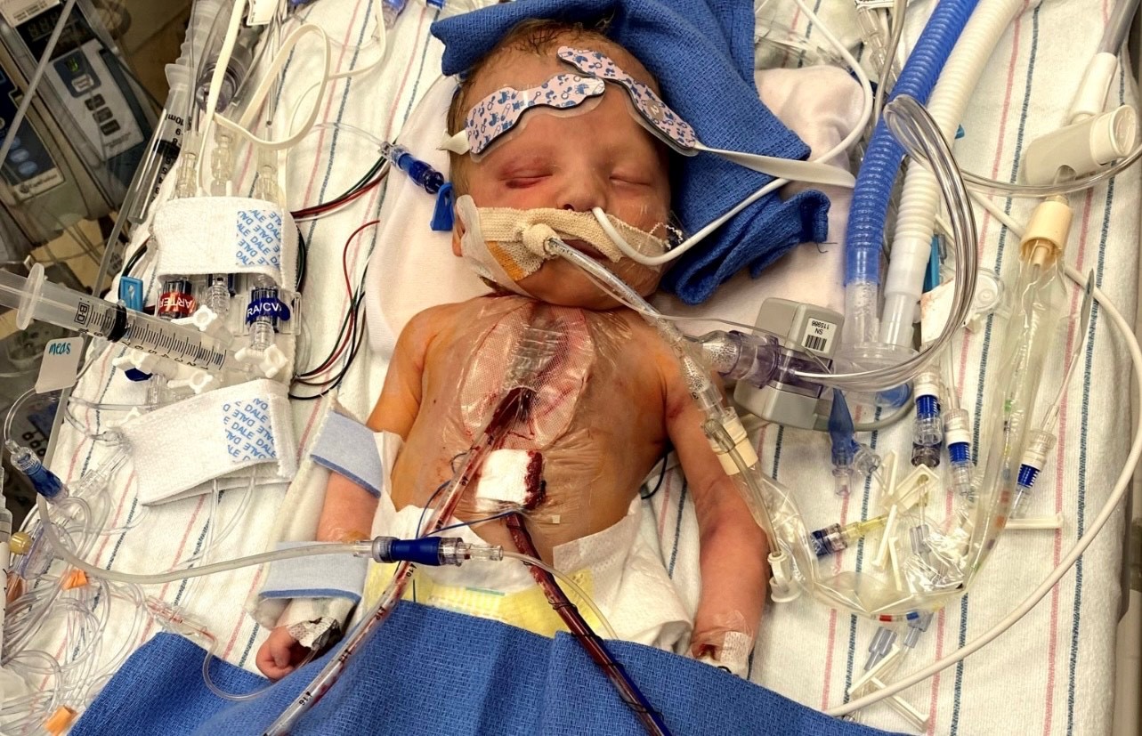 Hudson Hill after surgery