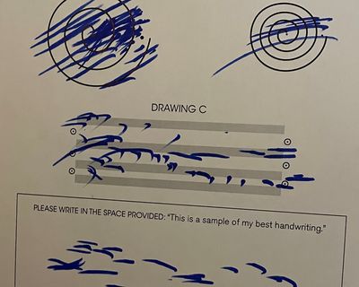 Munyon Patient Before