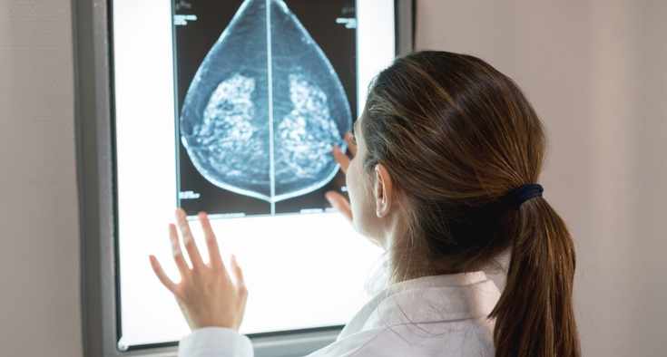 mammogram images
