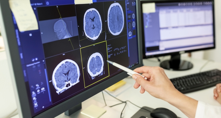 Find world-class brain tumor treatment at Novant Health Neurosciences Institute - New Hanover.
