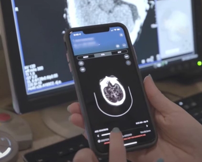FMC Stroke speed downpage