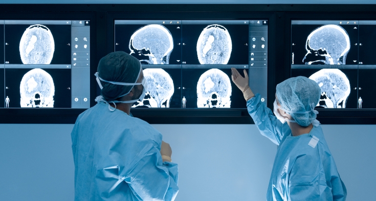 GammaTile Therapy: Advancements and benefits in brain tumor treatment