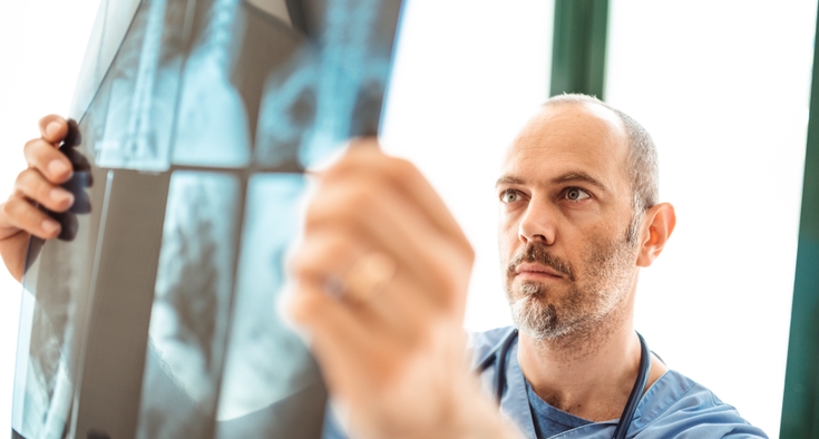 Current or former smoker? Your guide to lung cancer screening.