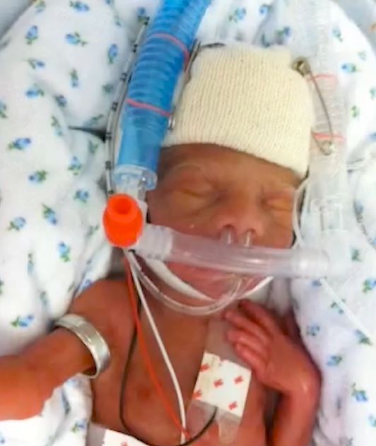 Tucker Hucks preemie shot