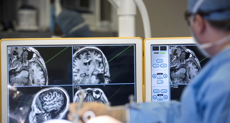 From telehealth collaboration to advanced interventions: Novant Health’s systemwide strategy for rapid stroke response