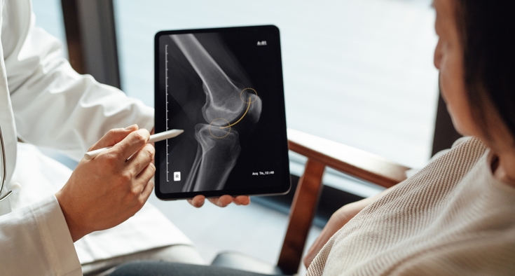 What to expect with a knee replacement Getty photo