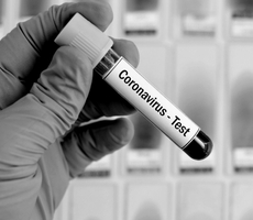 UPDATE: Coronavirus: What You Need to Know